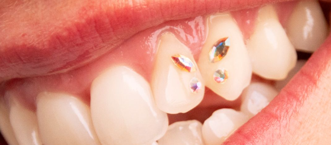 Estética Dental